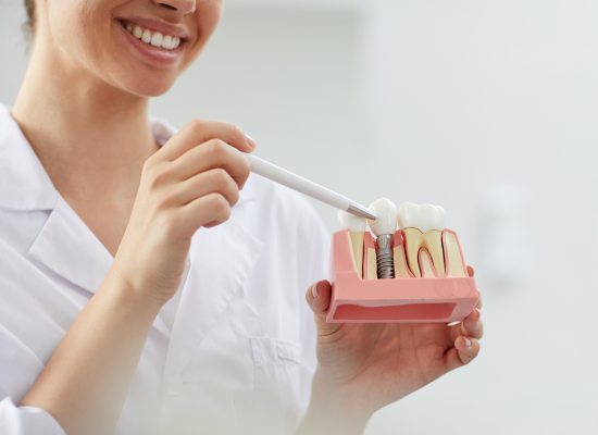 dental implants in brampton