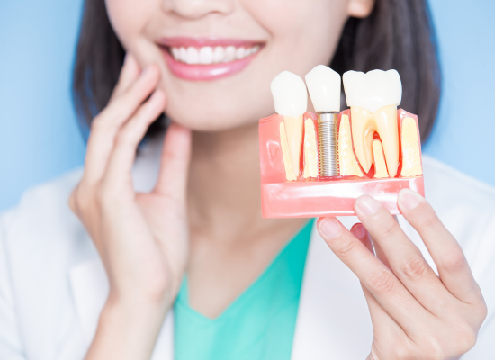 dental-implants-in-brampton